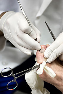 Foot surgery is absolutely painless, effective and in some difficult cases is the only option.
