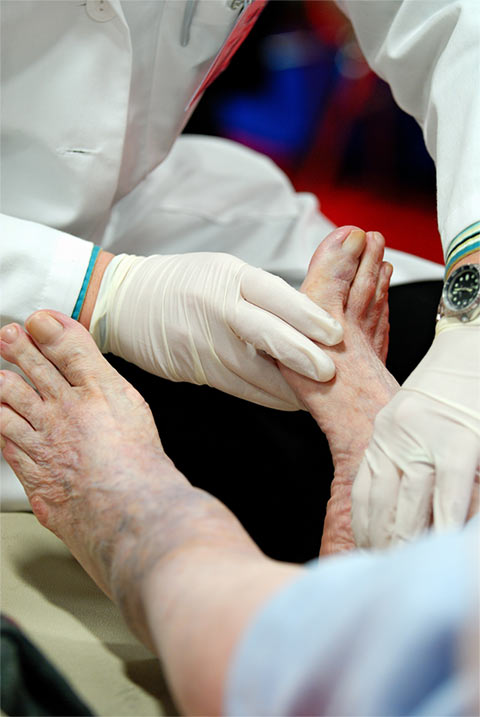 Diabetes requires a very special attention to feet health.