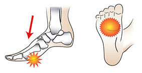 Forefoot pain causes.
